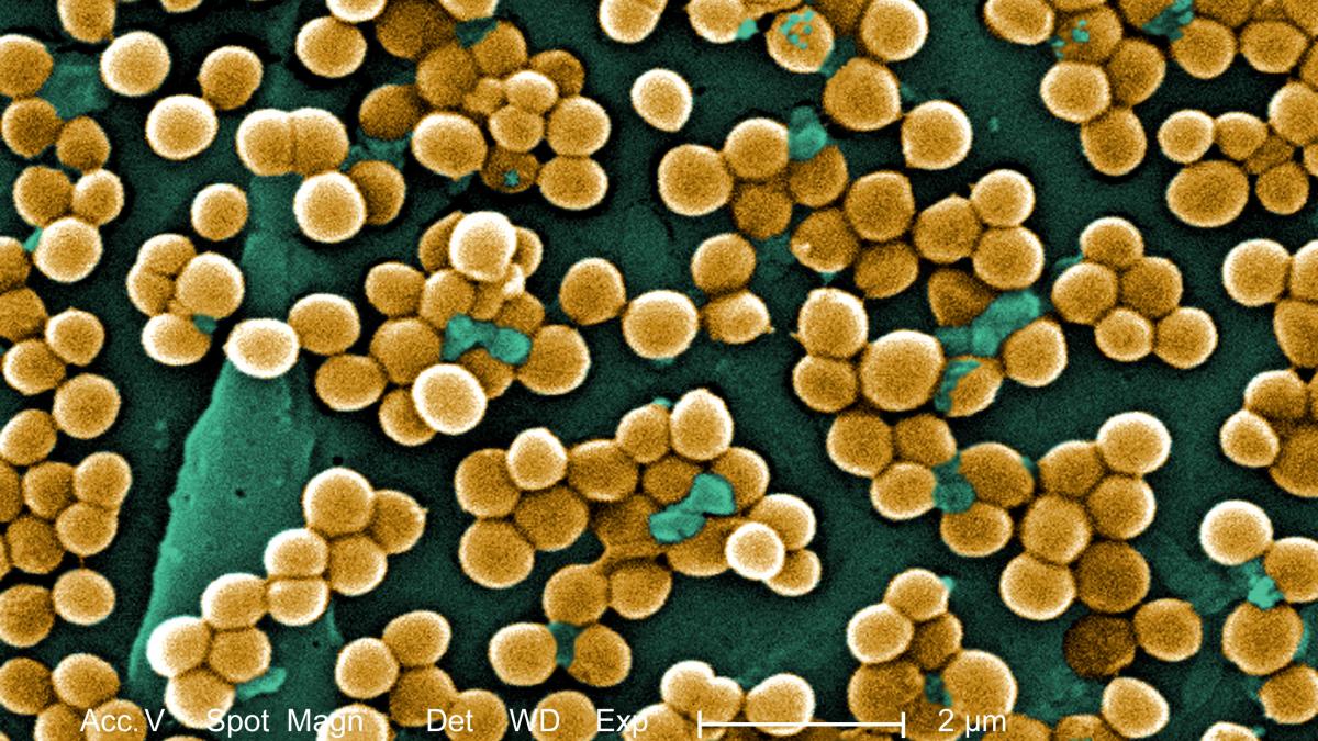 reteta veche de 1 000 de ani folosita in combaterea infectiilor cu stafilococul auriu