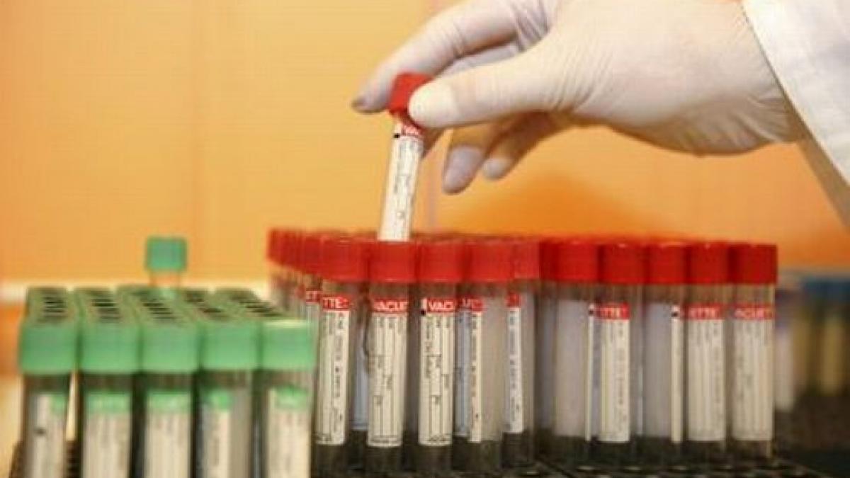 o noua terapie anti hiv realizata cu anticorpi naturali ofera rezultate promitatoare