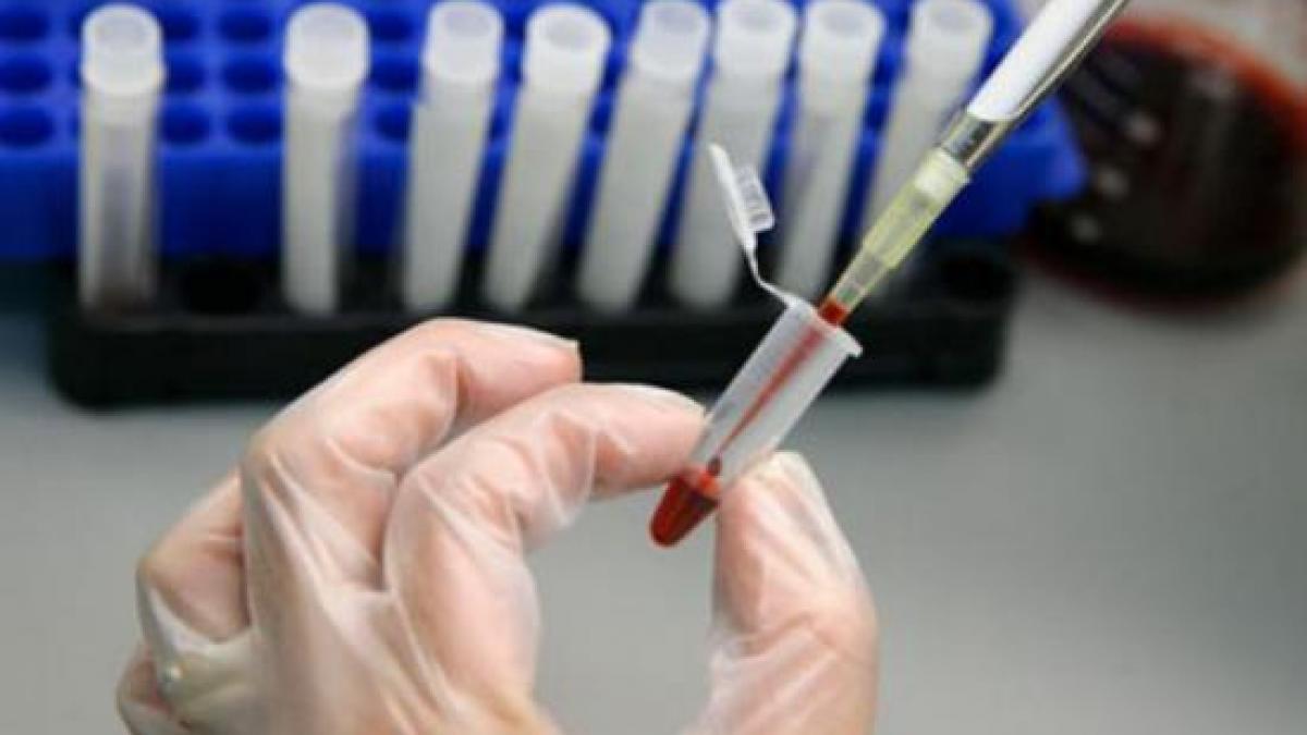 o noua terapie impotriva hiv virusul poate sa dispara total din sangele pacientilor