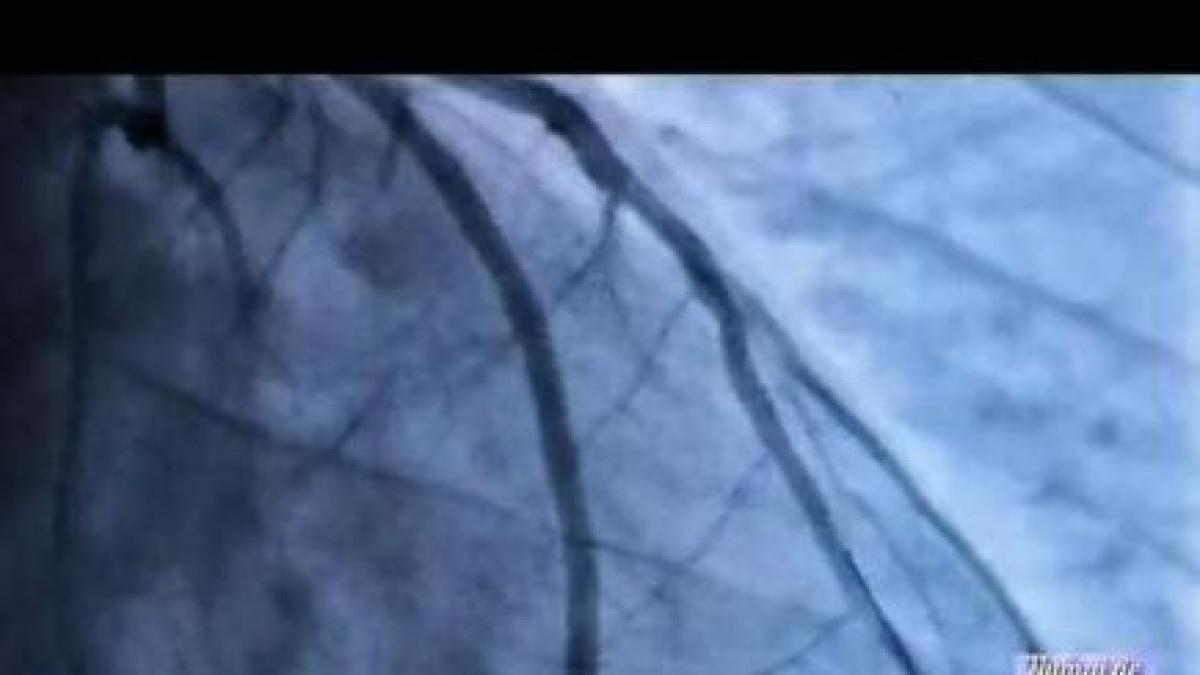 numai de bine cum incetinim imbatranirea