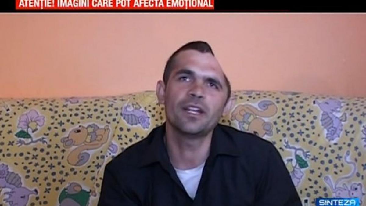 presa britanica impresionata de cazul romanului care si a pierdut jumatate de cap