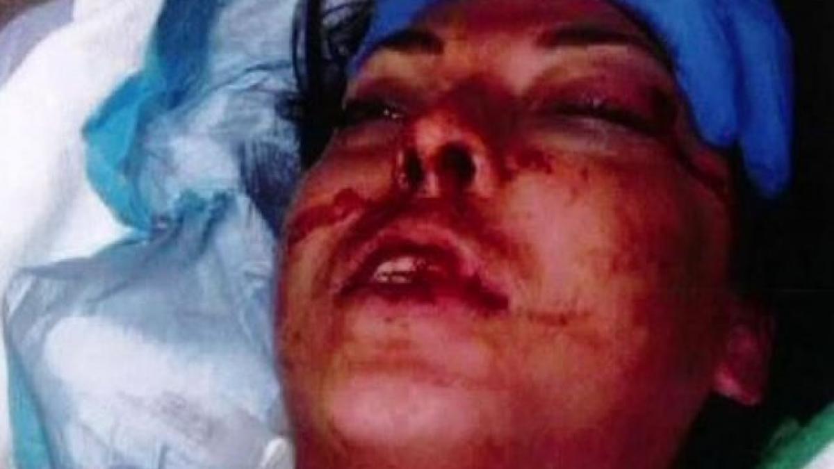 eram inconjurata nu era nevoie sa imi rupa oasele o femeie a fost desfigurata raspunsul merita asta