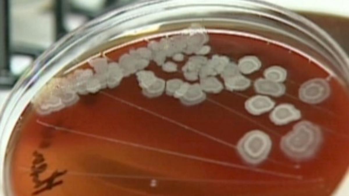 pentagonul a trimis din greseala antrax la noua laboratoare din sua si la o baza militara din