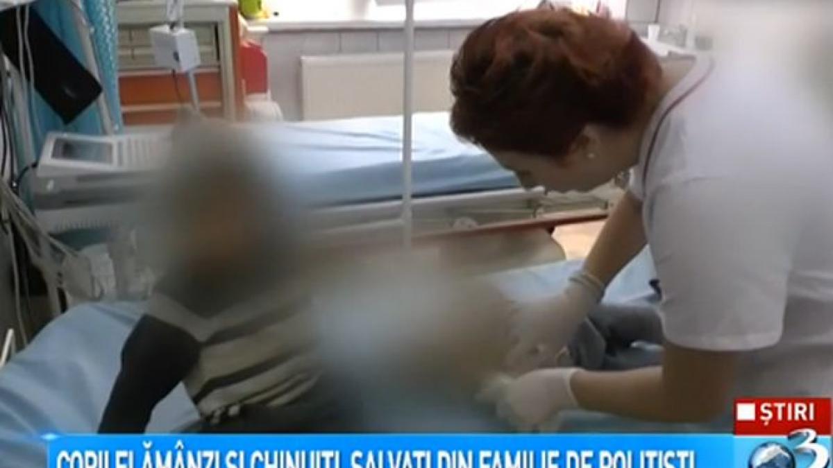 caz dramatic la bicaz patru frati cu varste intre 1 an si 6 ani au ajuns la spital flamanzi si