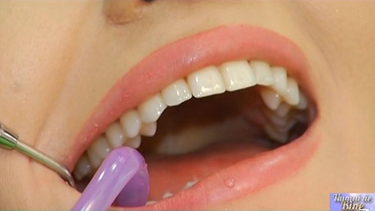 numai de bine paradontoza o boala cu efecte foarte grave