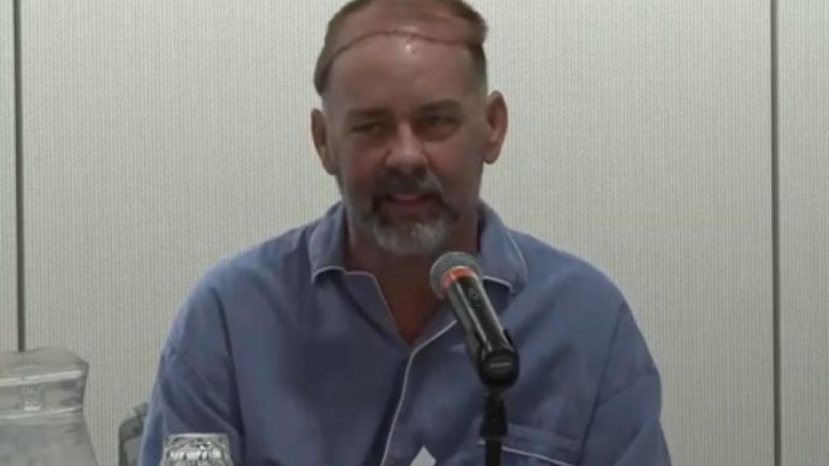 premiera medicala senzationala chirurgii americani au realizat primul transplant de craniu si scalp