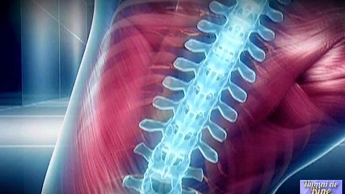 numai de bine meseriile care ne expun durerilor de spate