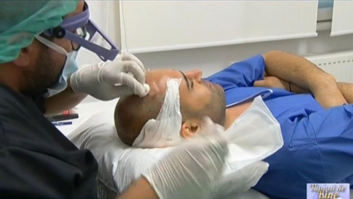 numai de bine solutii moderne impotriva caderii parului