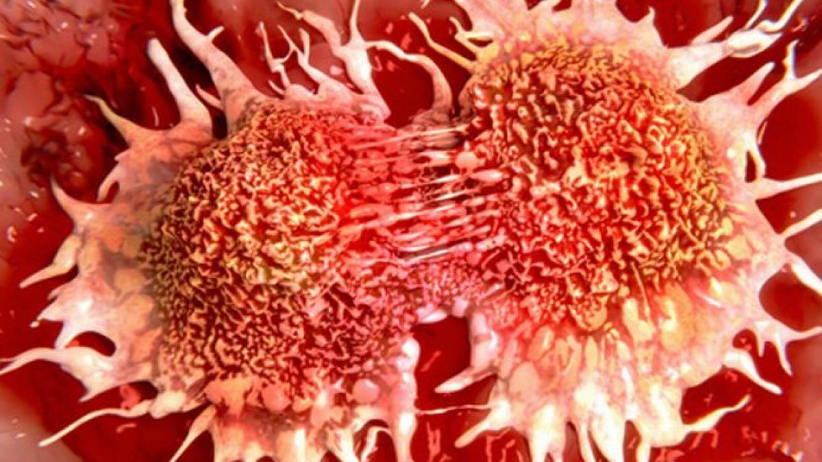 medicament revolutionar impotriva cancerului dubleaza speranta de viata a bolnavilor