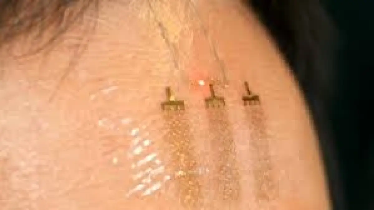 dermatologii desfiinteaza noua moda de pe plaja ce trebuie sa stiti despre tatuajele solare