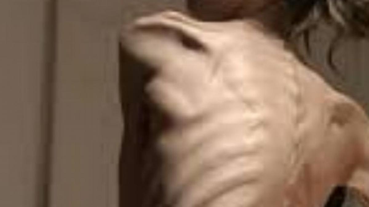 povestea impresionanta a tinerei care a ajuns sa cantareasca 32 de kilograme