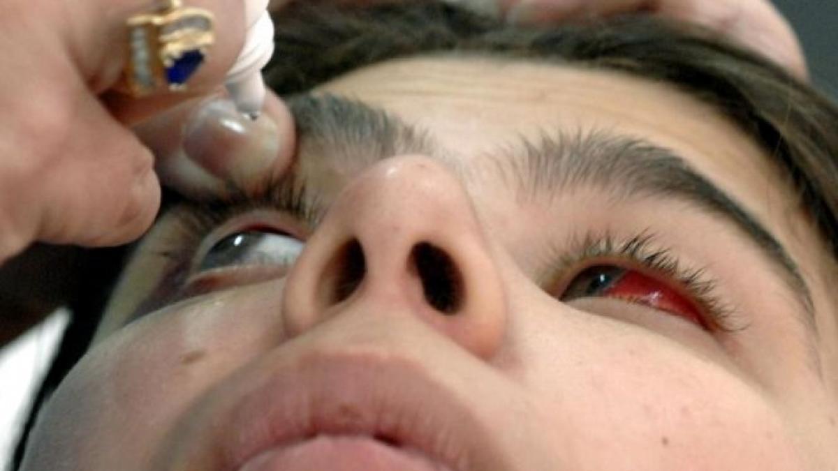 au aparut picaturile pentru ochi care pot dizolva cataracta