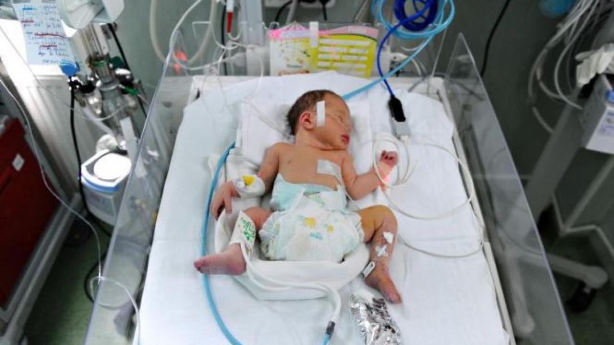 au uitat sa dezactiveze flash ul bebelusul fotografiat a ramas orb