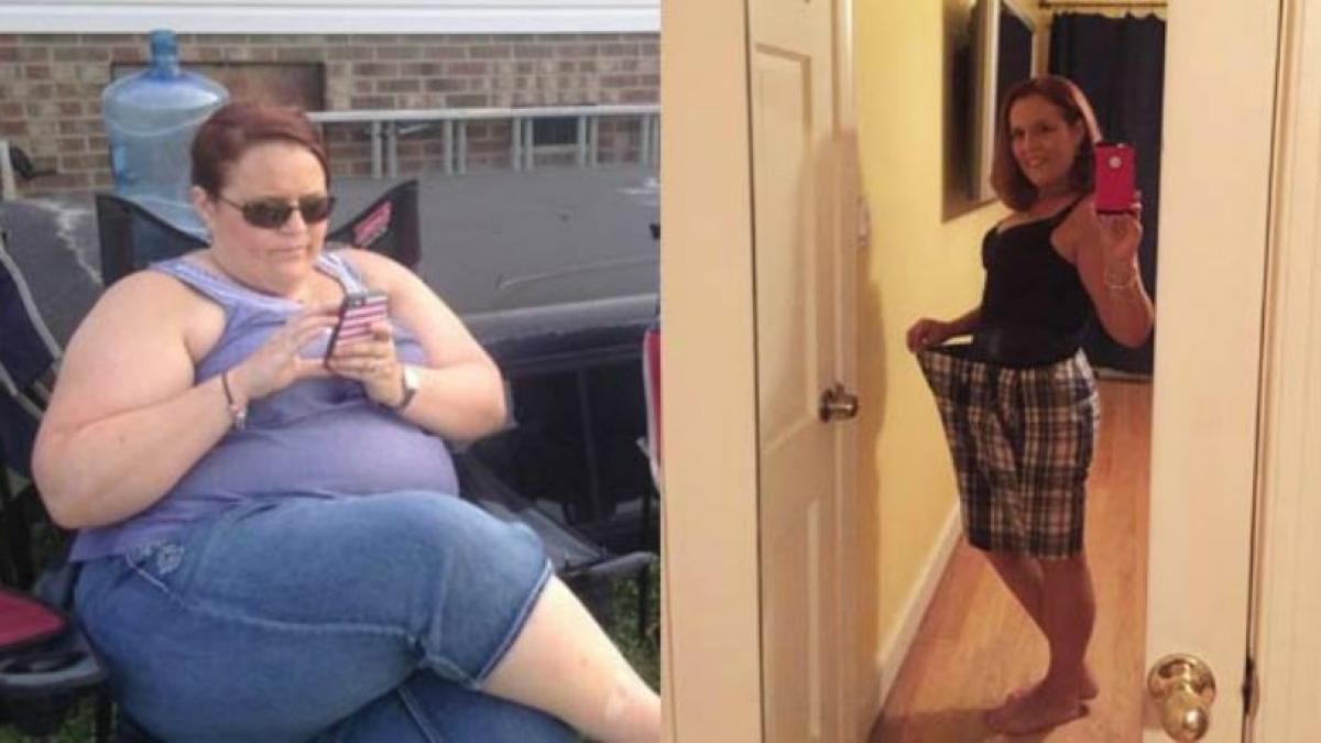 a vrut sa se opereze pentru a slabi dar doctorii i au spus ca e prea grasa ce a facut este