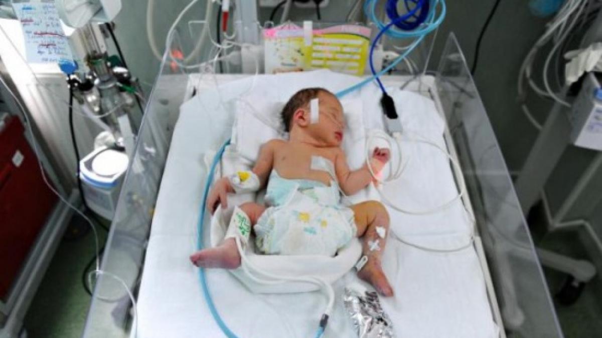 bebelus de 9 luni batut de fratele mai mare