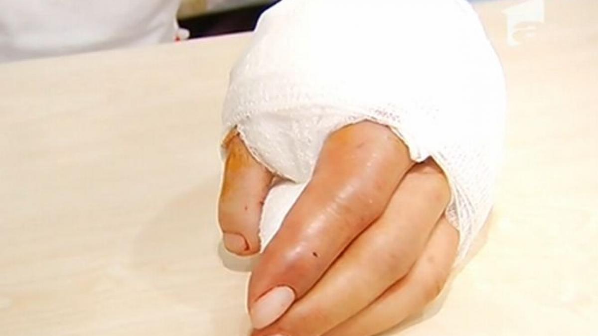 degetul de la picior i a completat mana