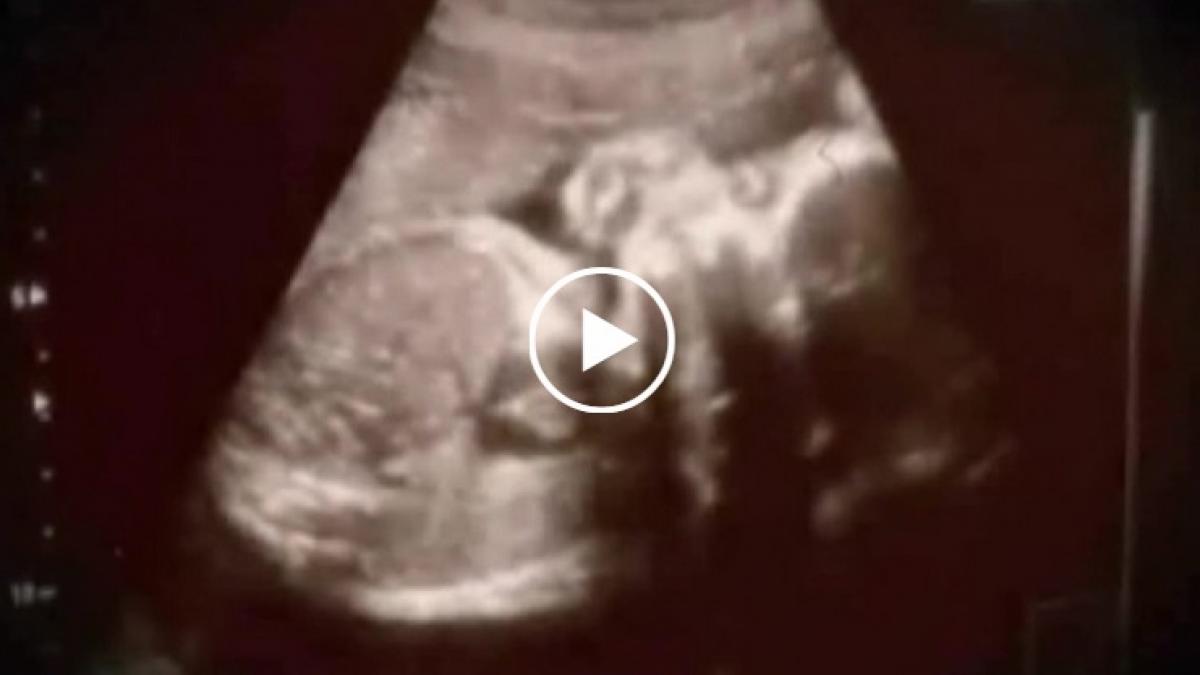 a nascut la 11 ani vestea care face inconjurul lumii