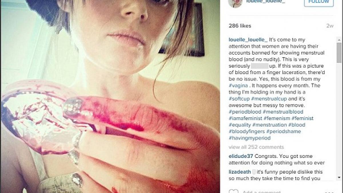 a pus poza asta pe un cont de socializare dupa care toti prietenii i au zis sa se sinucida ce a