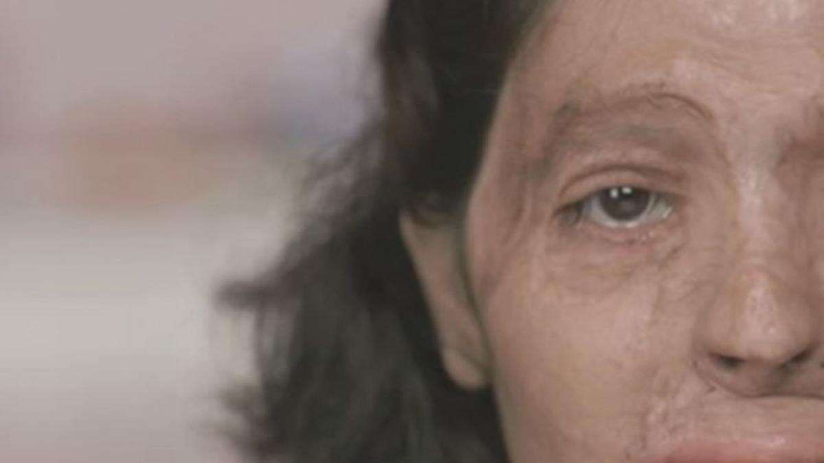 sfaturi de infrumusetare de la o tanara desfigurata povestea ei este cutremuratoare