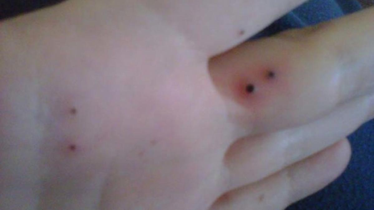 boala ciudata de care sufera aceasta femeie a fost declansata de un produs pe care il folosesc