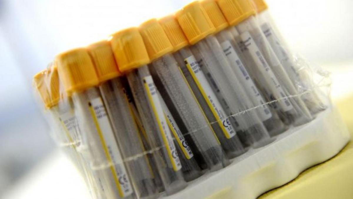 analizele medicale la privat costa luni intregi de asteptare