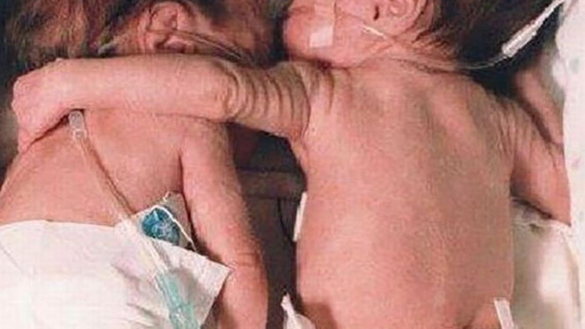 si a imbratisat sora care era pe moarte nimeni nu se astepta sa se intample asta