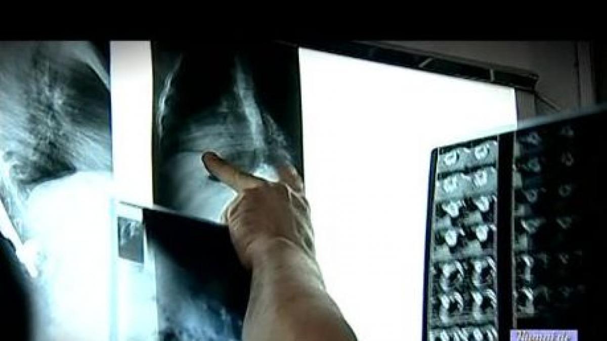 numai de bine problemele coloanei vertebrale pot duce la impotenta