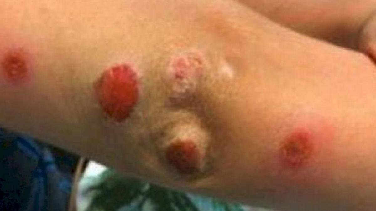 i s ar putea intampla si copilului tau s a jucat pe un tobogan gonflabil si s a intors acasa bolnav