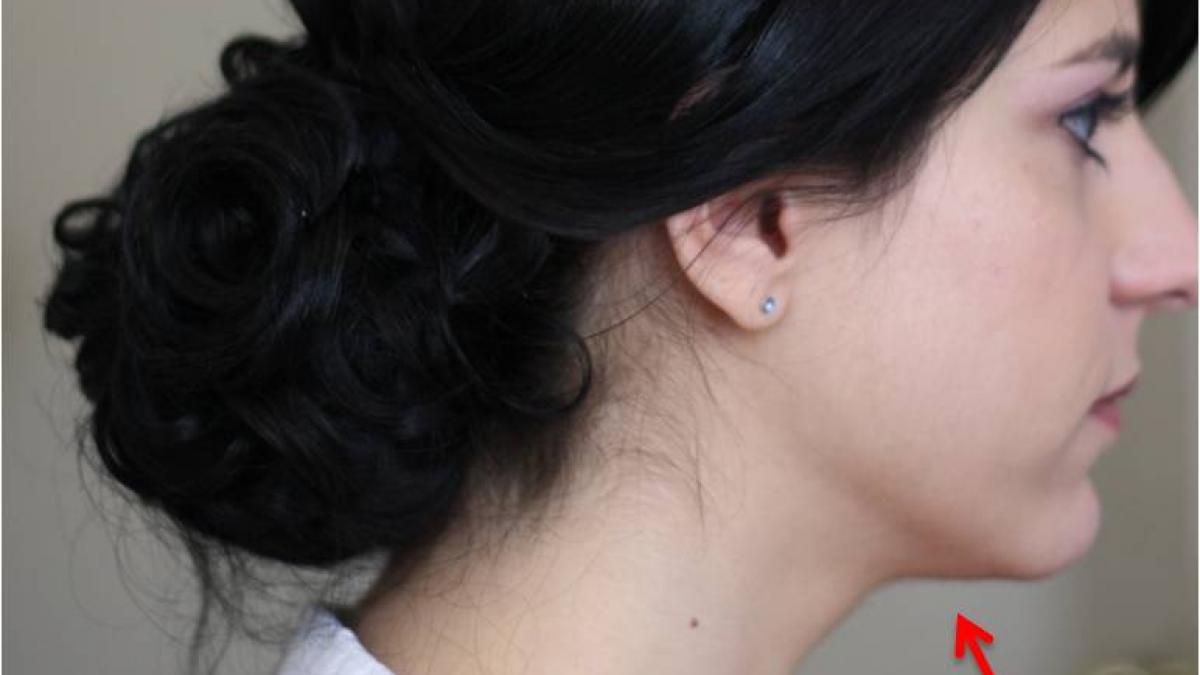 trucuri pentru a preveni si trata barbia dubla si ce o cauzeaza