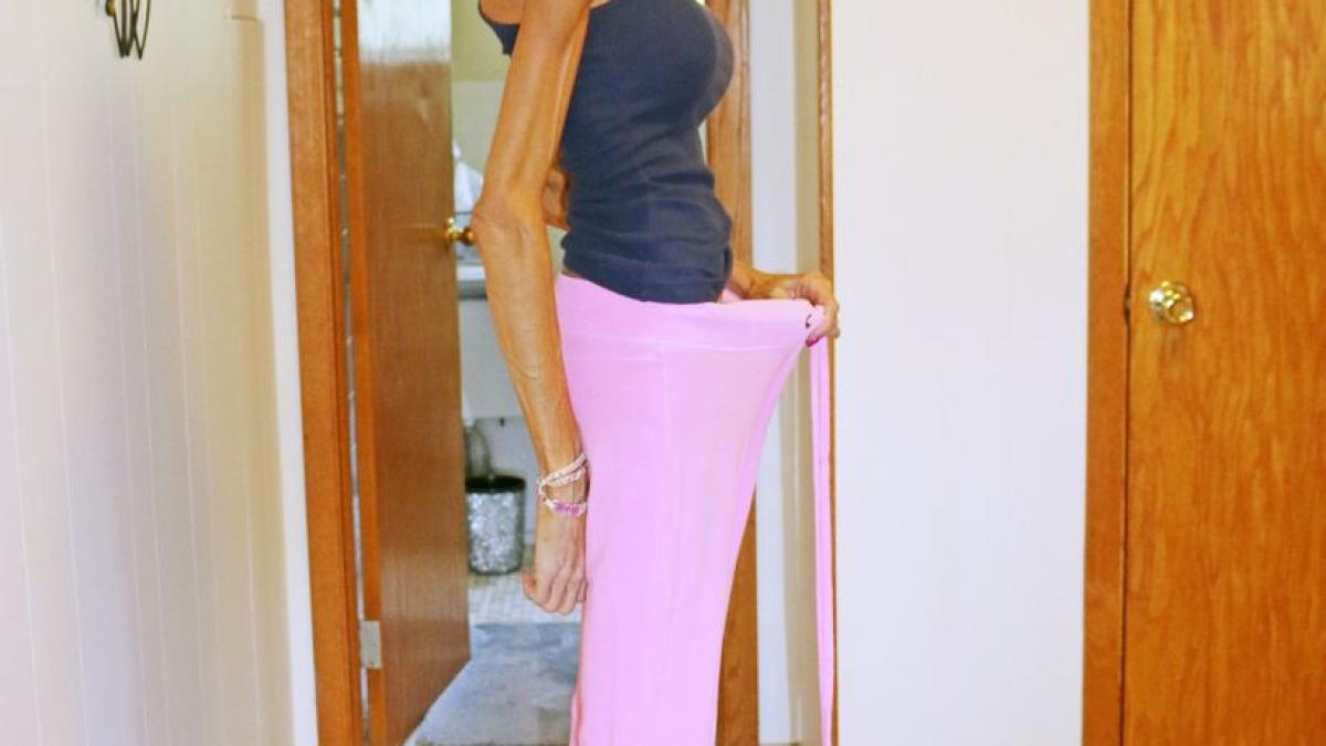 povestea femeii care moare de foame nu poate sa manance absolut nimic de doi ani