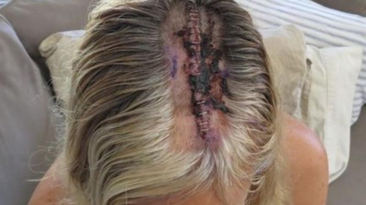 a fost operata pe creier confesiuni impresionante m am intrebat de ce nu m am purtat mai frumos cu