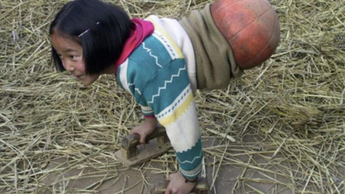 fata care a demonstrat ca orice este posibil are o minge de baschet in locul picioarelor