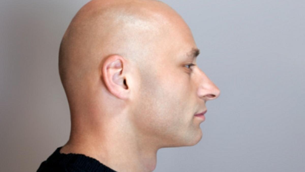 cum sa opresti caderea parului rezultate vizibile in scurt timp