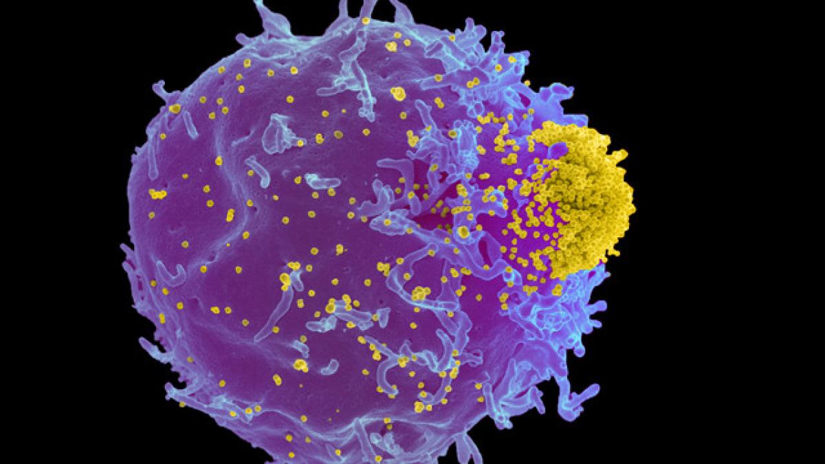 studiu exista un nor de gunoi microscopic in jurul corpului uman