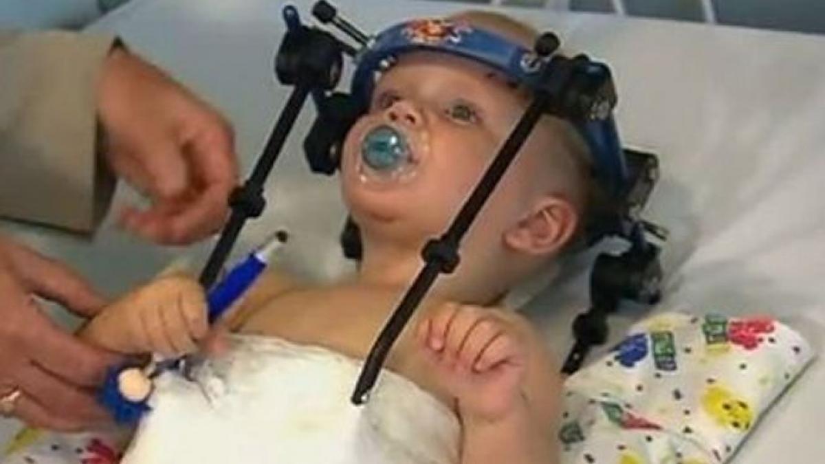 accident oribil capul copilului s a desprins de trup ce au facut medicii este un miracol