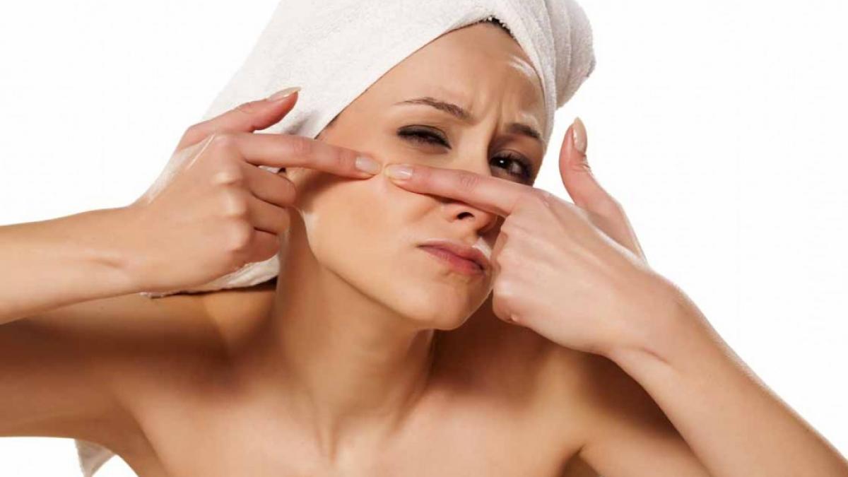 numai de bine cum sa scapi de urmele lasate de acnee