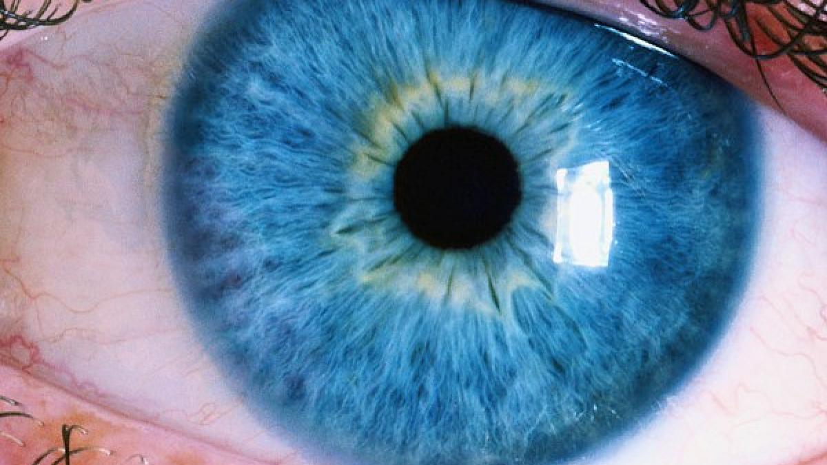 irisul oglinda sanatatii tale ce secrete ascund ochii tai