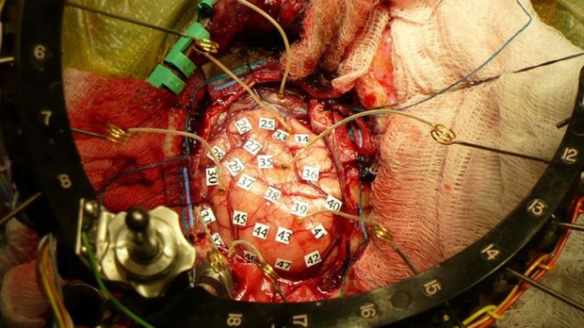 creier uman palpare studiu craniu