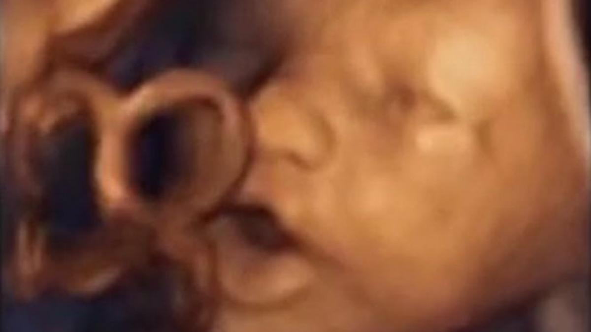 un bebelus canta in burta mamei