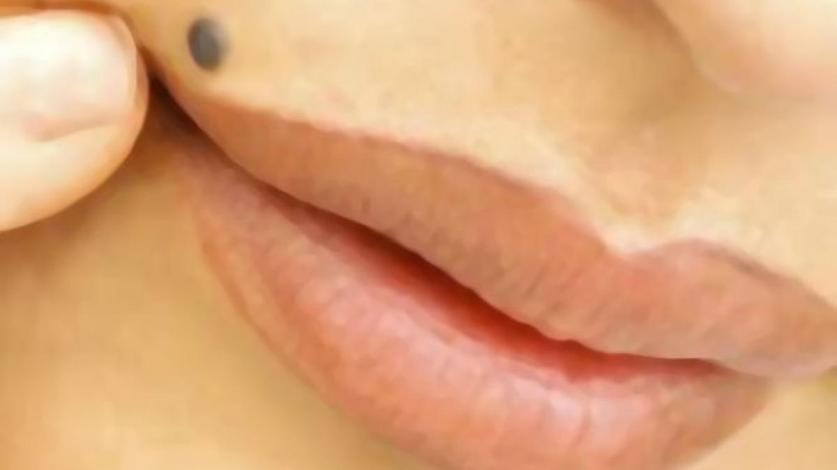 pembrolizumab medicament cancer piele