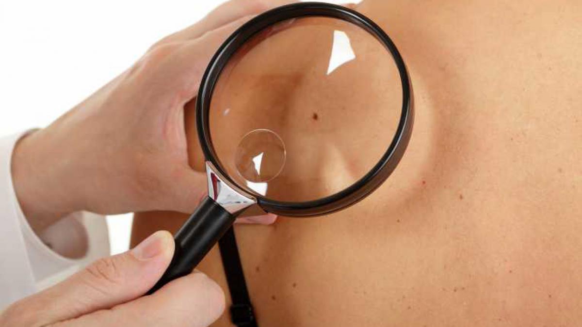 cea mai agresiva forma de cancer ar putea fi declarata boala profesionala