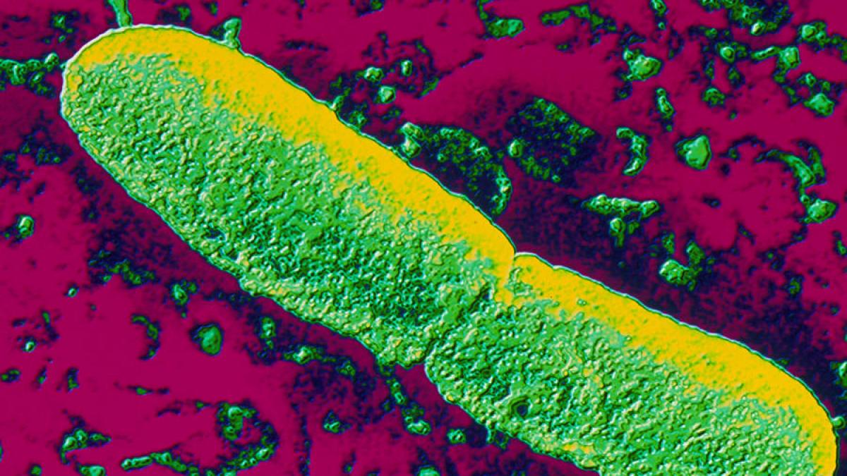 detaliul legat de ciuma care uimeste lumea stiintifica