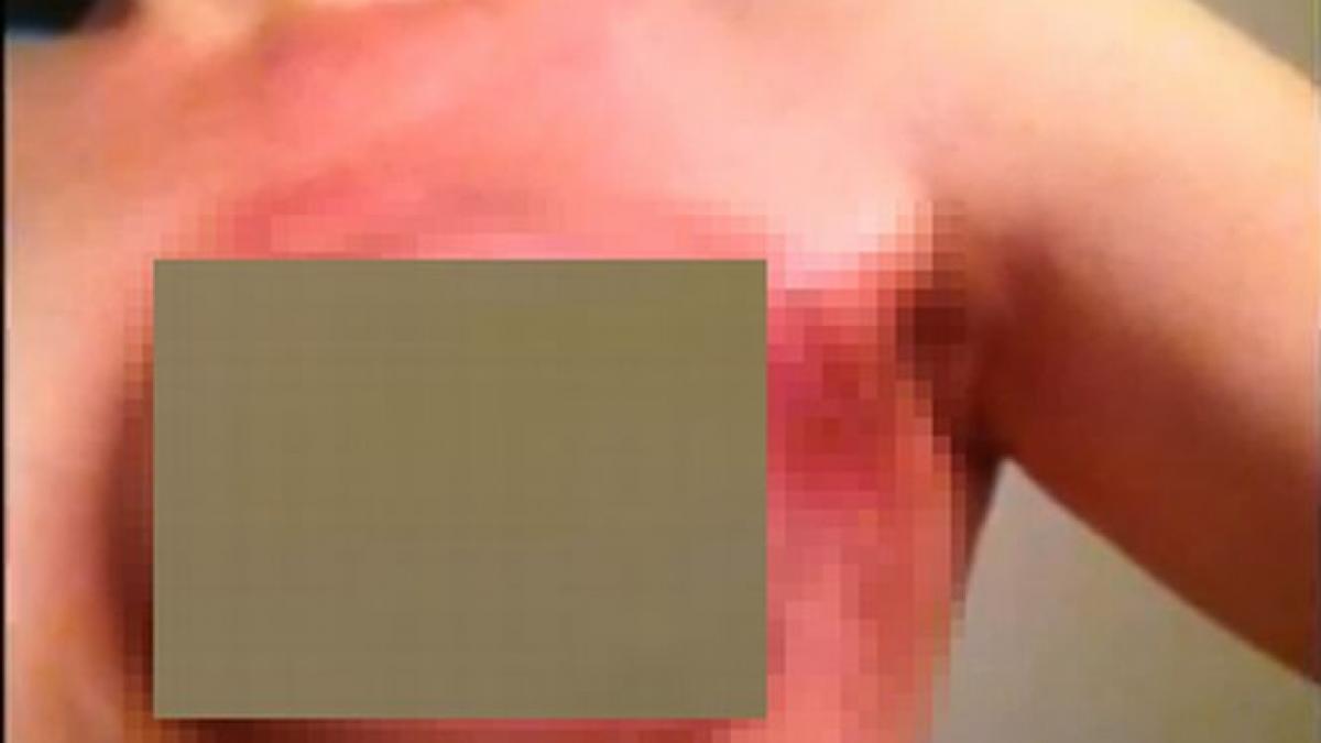 adevar cancer la san imagini socante