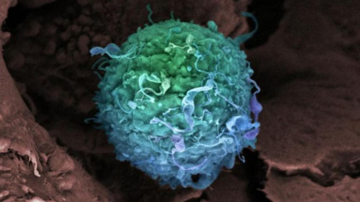 grenadele microscopice o noua terapie revolutionara contra cancerului