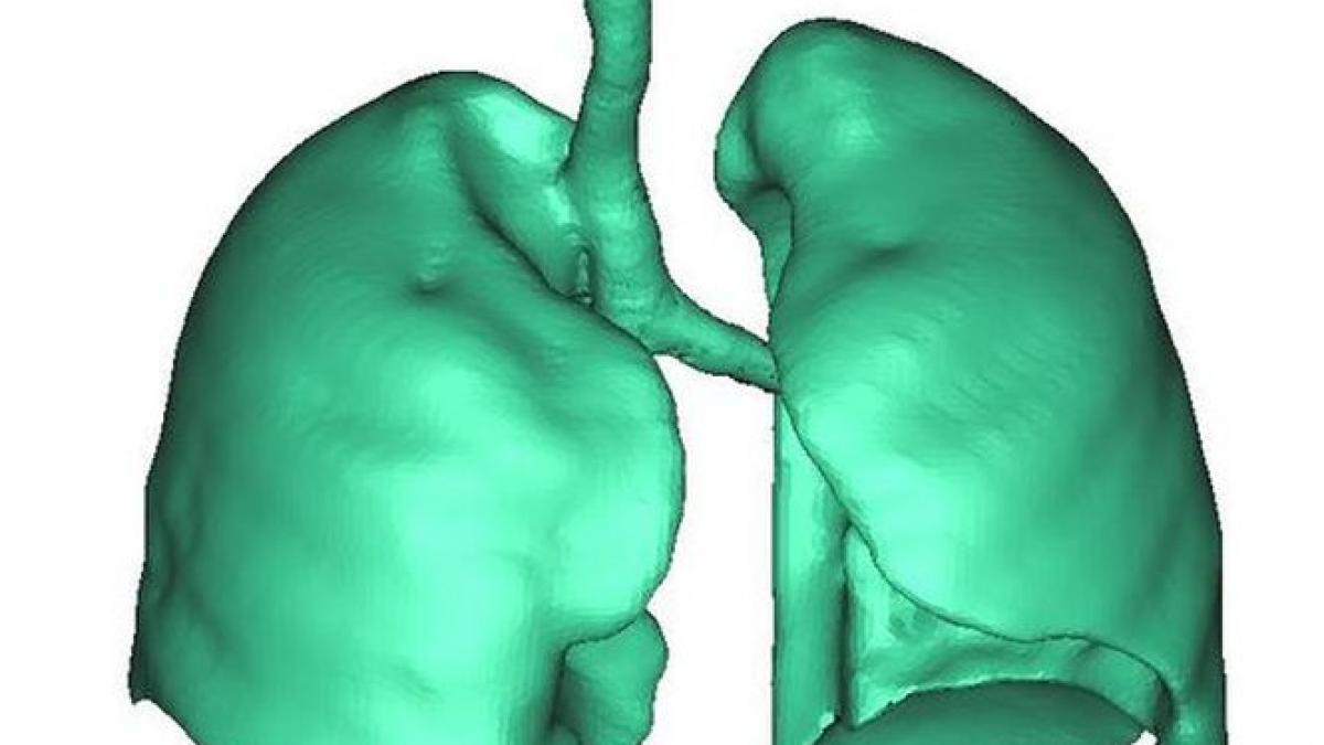 ranit club colectiv plaman artificial