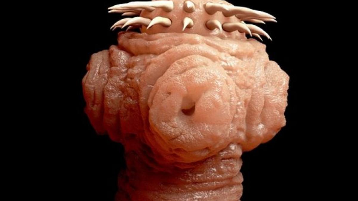 cancer tenie parazit celule