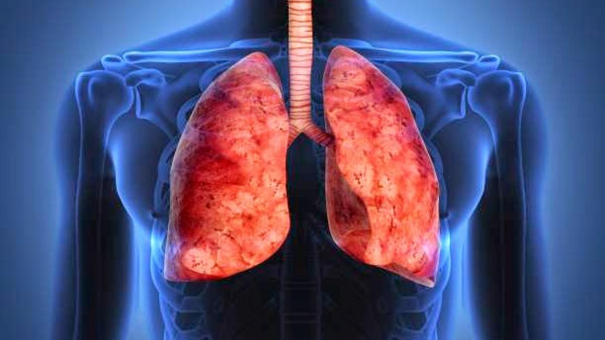 cum poti scapa de nicotina din corp cel mai rapid mod de detoxifiere