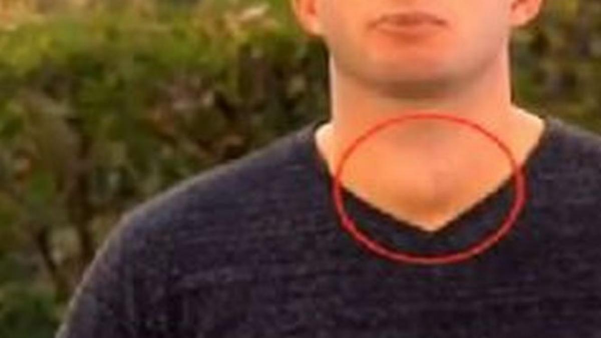 cum a aflat un prezentator tv ca are cancer