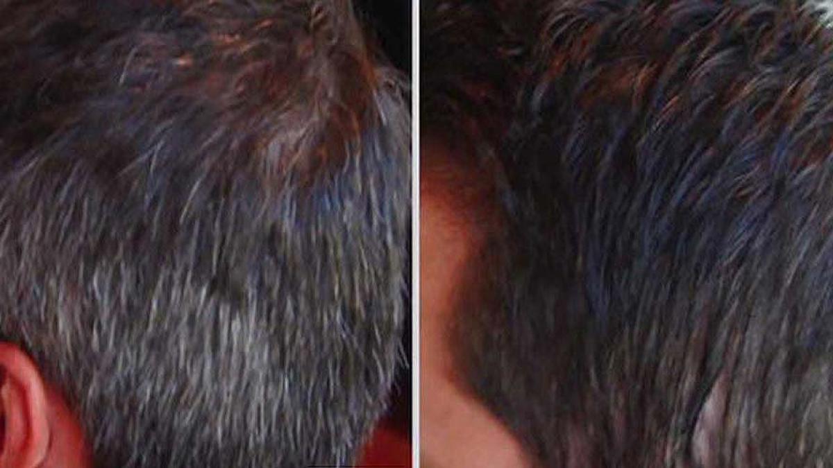 p descopera metoda revolutionara care te scapa de parul carunt