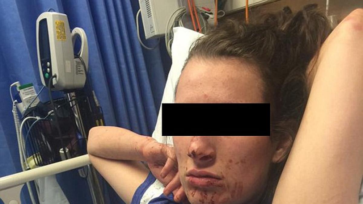 a cazut pe scari si a batut iubita pana a desfigurat o fotografiile care au socat facebook ul